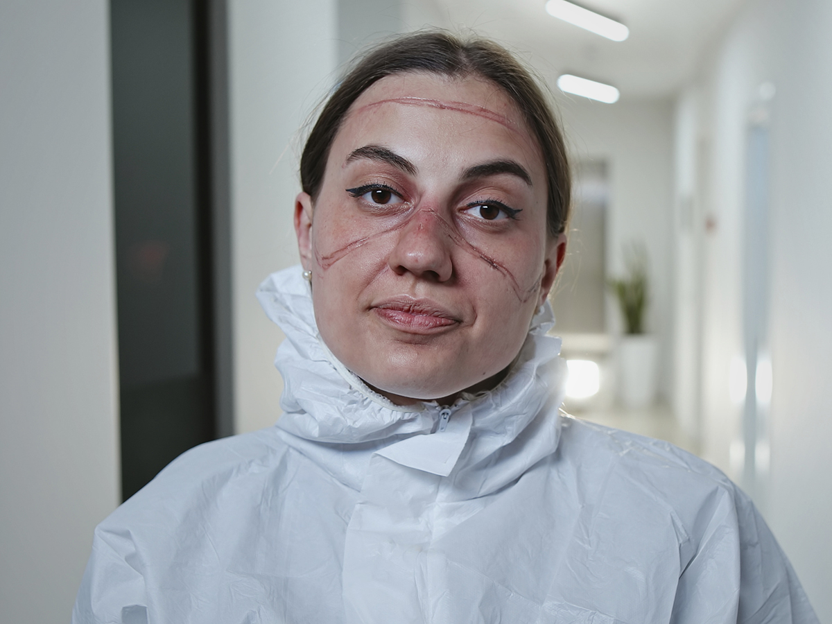 Una enfermera muestra las marcas de la mascarilla en su rostro en plena crisis del COVID 19